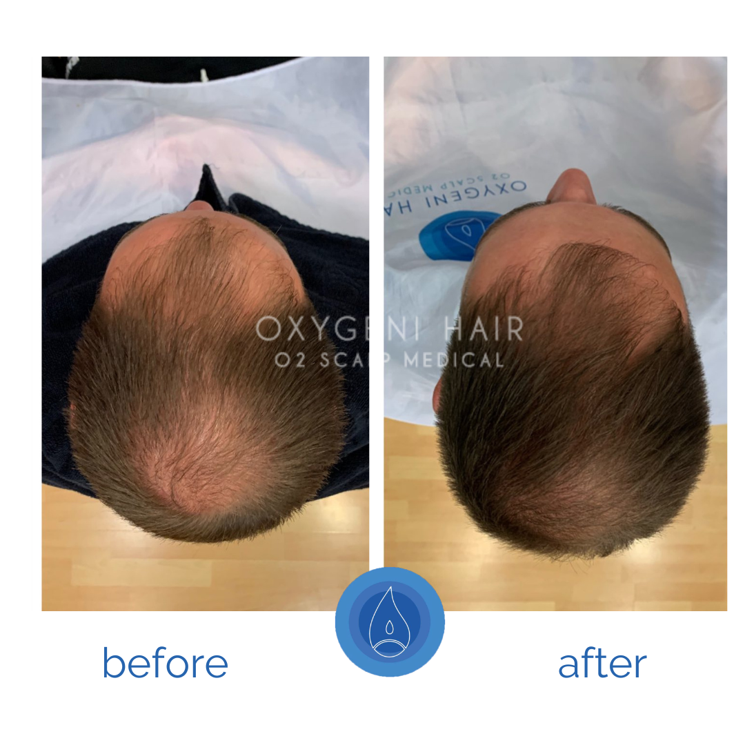 Oxygeni Hair & Cosmetics Hungary Facebook ad