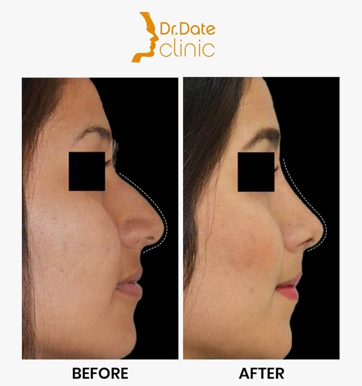 Dr_Date_Clinic Facebook ad: Another remarkable transformation of one of our patients…
