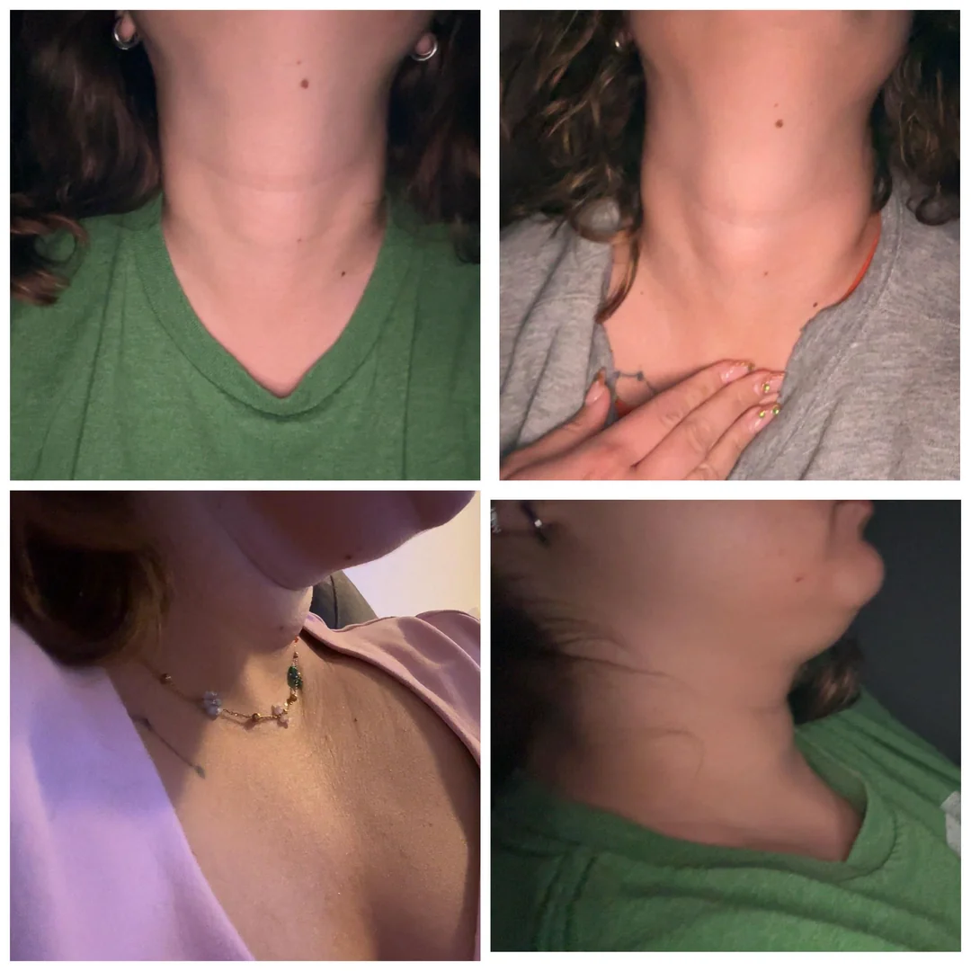 Stephanie Anderson Facebook ad: Natural Thyroid Support