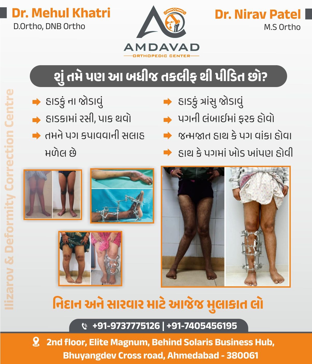 Amdavad Orthopedic Center Facebook ad: સારવાર માટે મુલાકાત લો