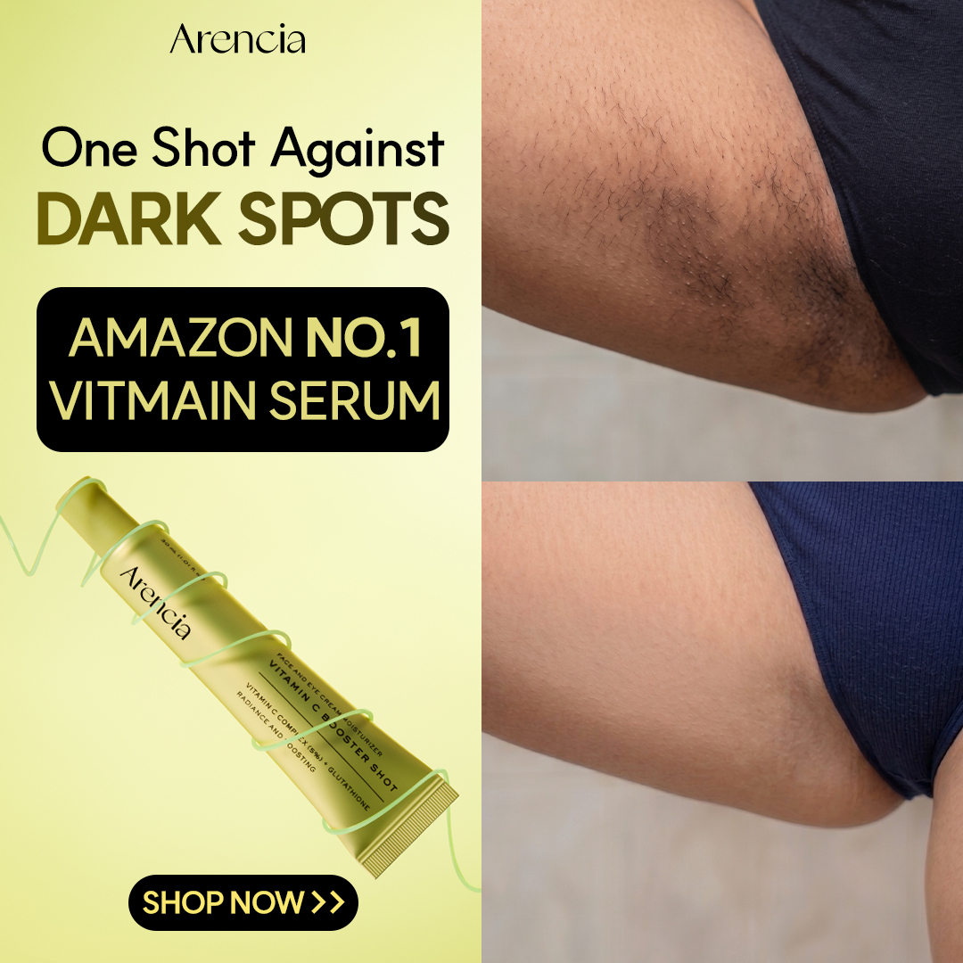 Arencia Global Facebook ad