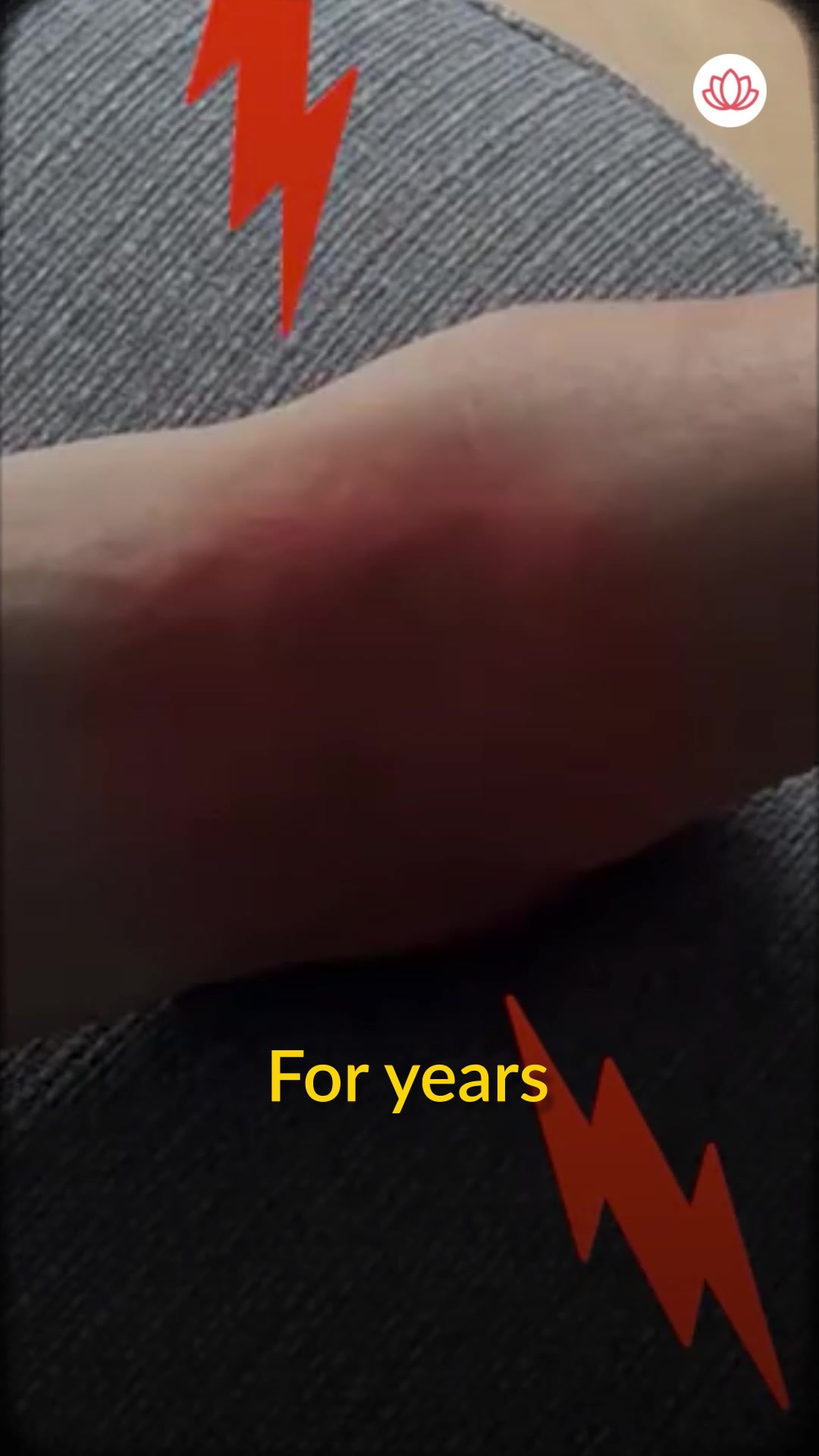 Zanskar: Muscle & Joint Relief Facebook ad: Burning, Tingling Feet? Try Zanskar