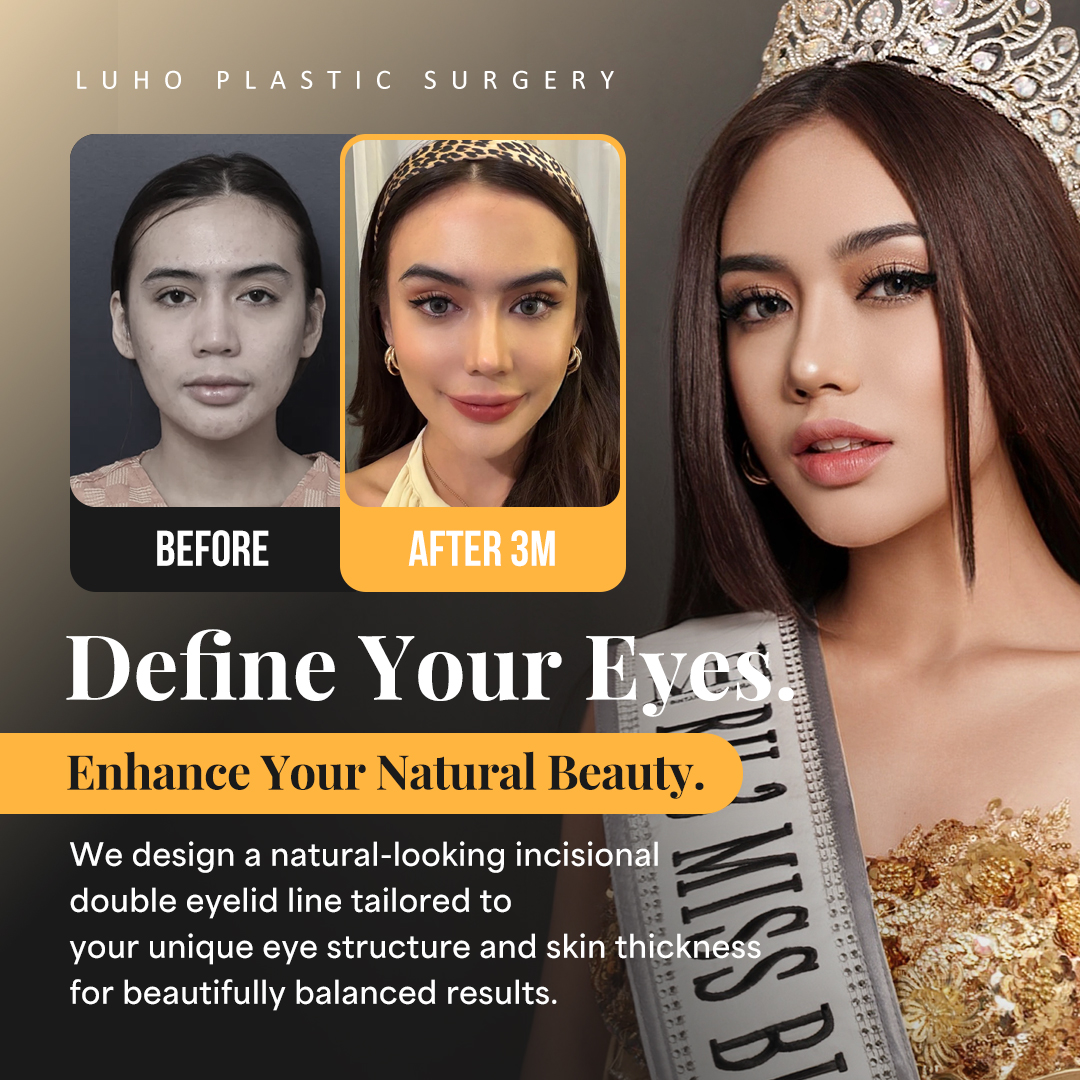 루호성형외과 Facebook ad: Incisional Double Eyelid Surgery|Beautiful Eyes Designed…