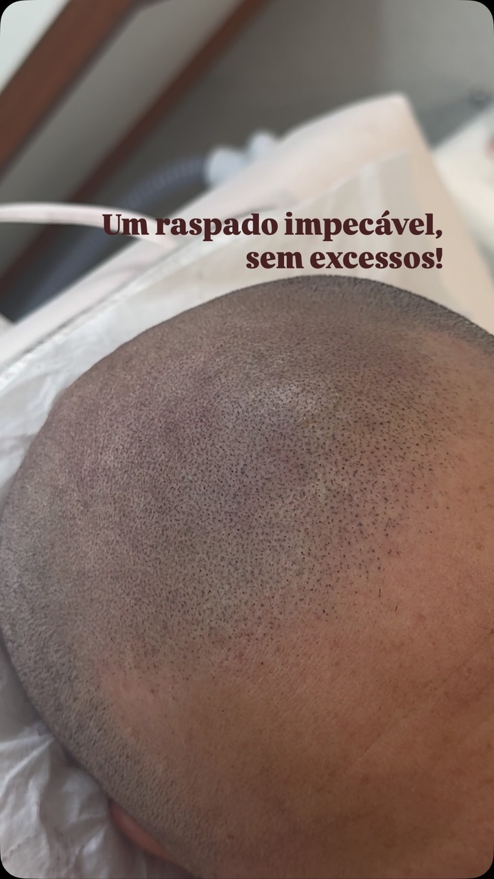 Adriana Hortmann Micropigmentação Capilar Facebook ad: A elegância está nos detalhes!