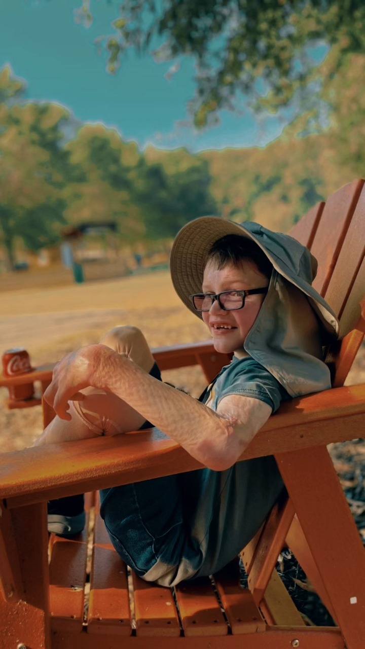 Georgia Firefighters Burn Foundation Facebook ad: The children in our GFBF community are more…