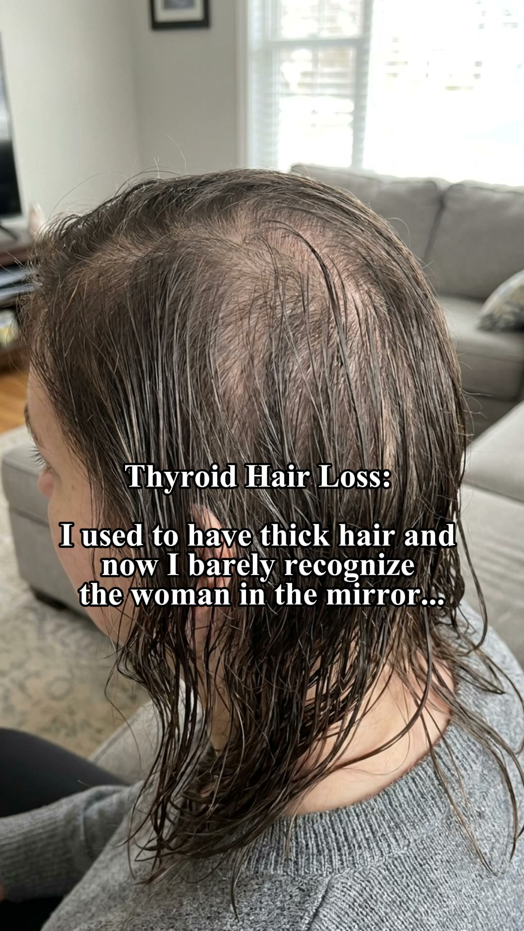 Bloom & Bond Facebook ad: Treating Your Thyroid Won't Bring Your Hair Back