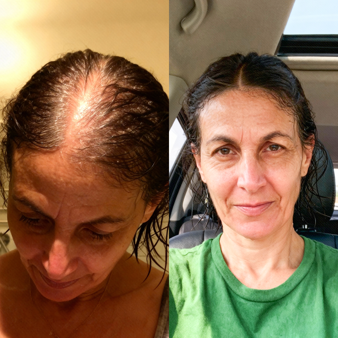 True Hair Forum Facebook ad