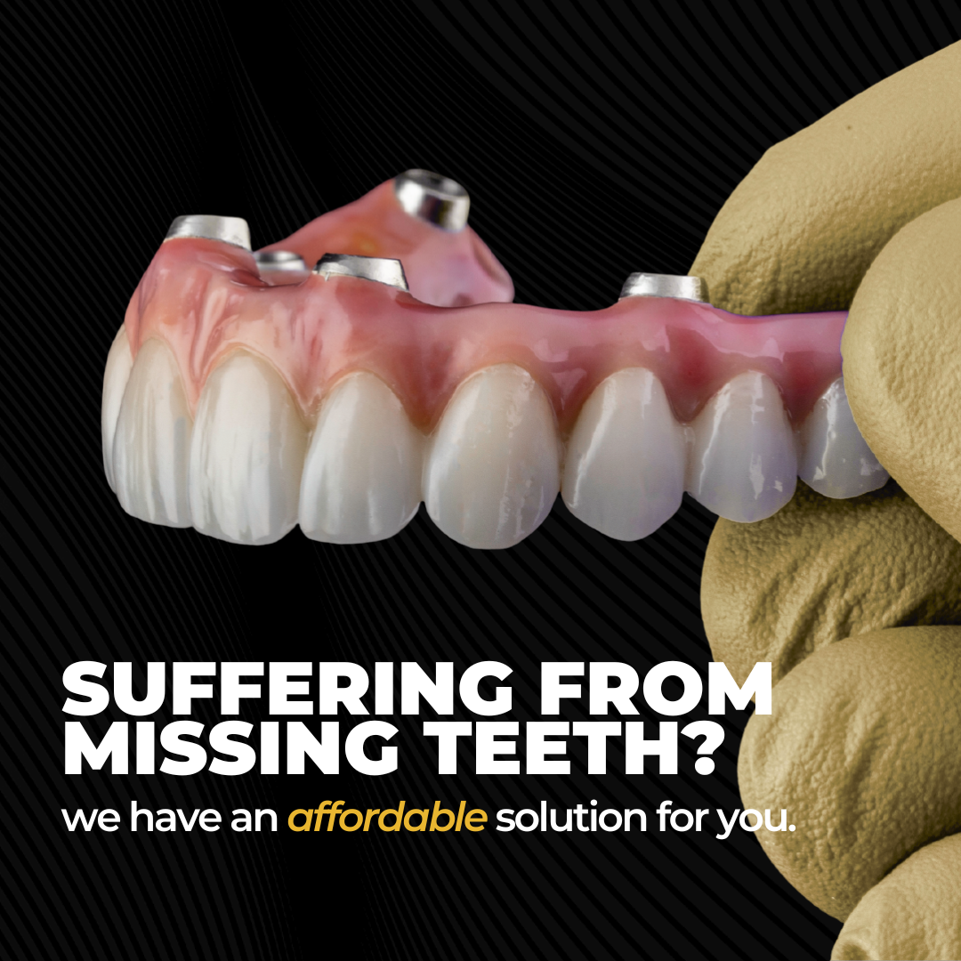 Elite Dental Cosmetics Facebook ad: Affordable Dental Implant Options
