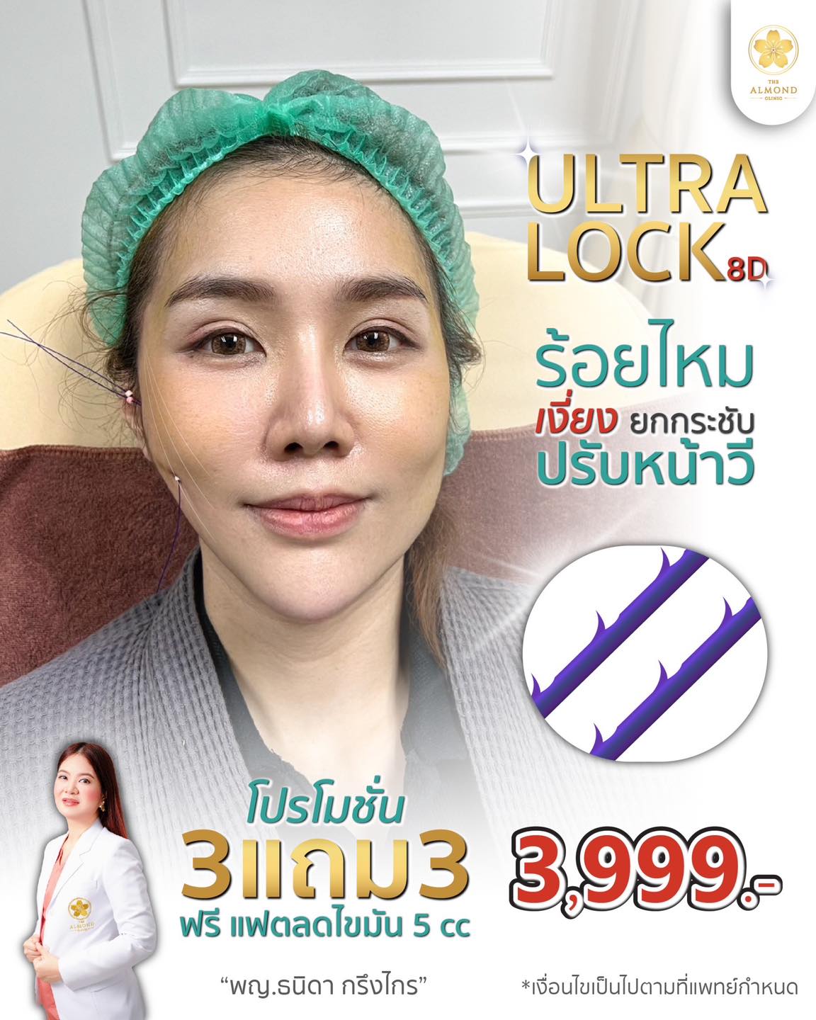 The Almond Clinic Facebook ad