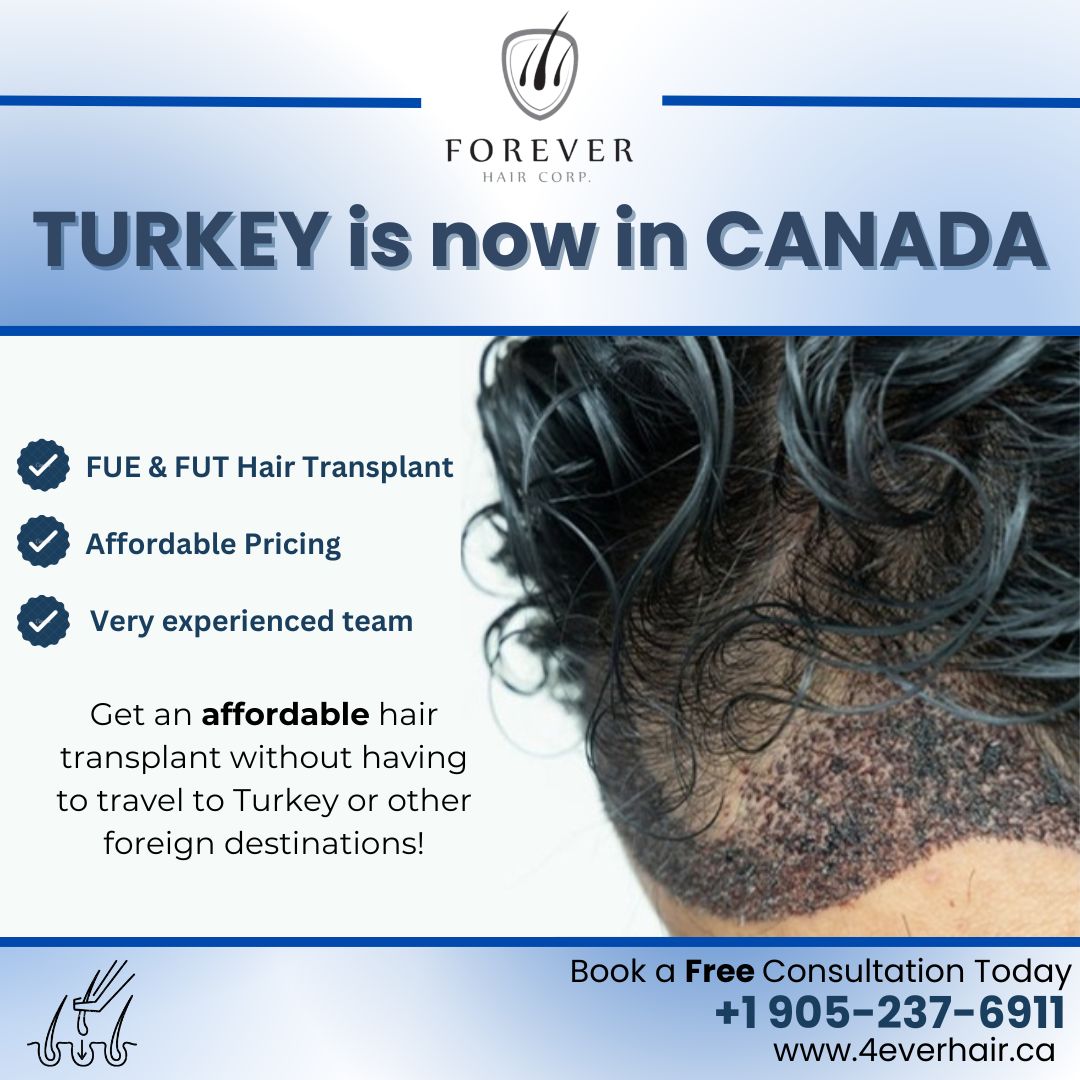 Forever Hair Facebook ad: Free Consultation | 30+ Years of Experience