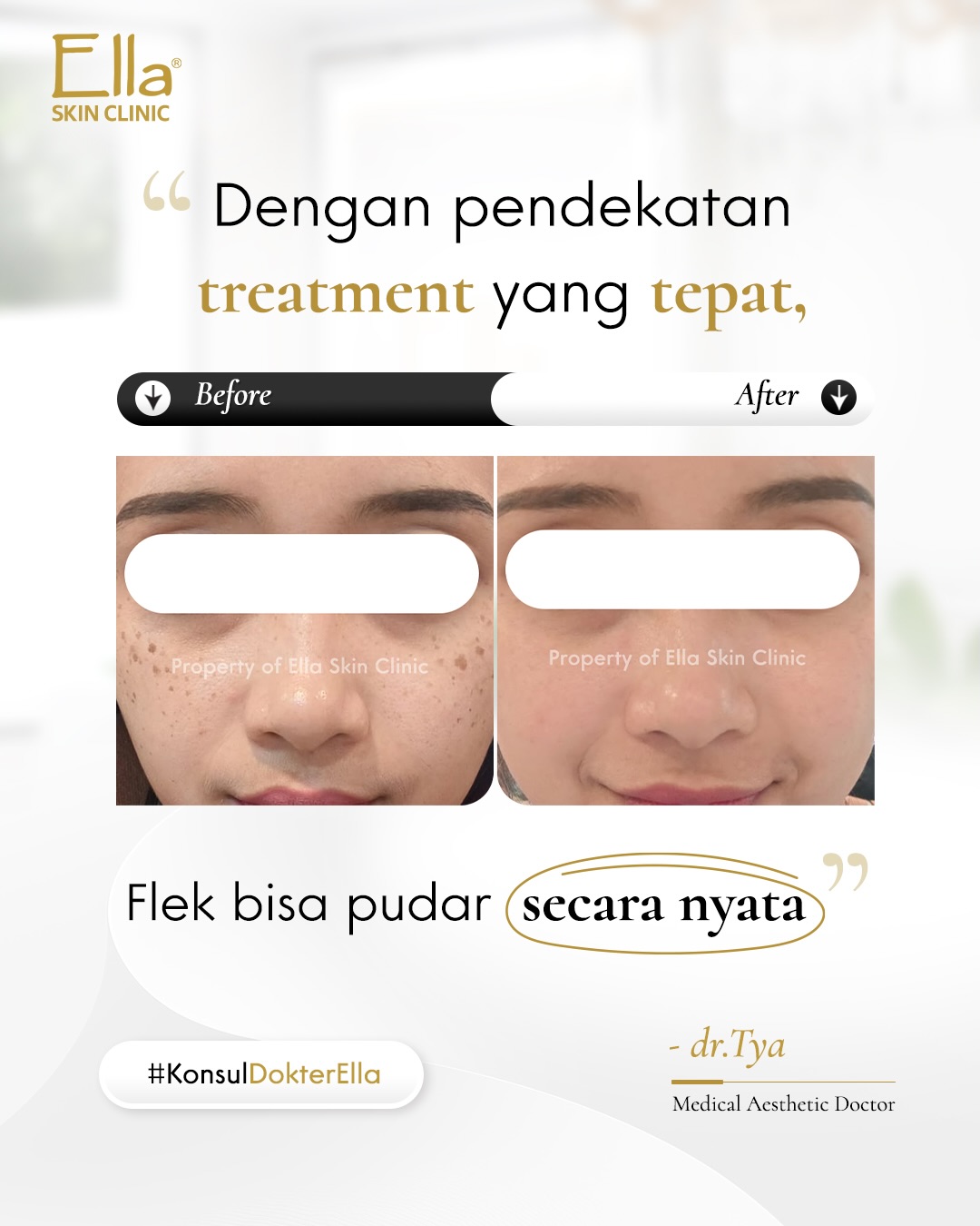 Ella Skin Care Official Facebook ad