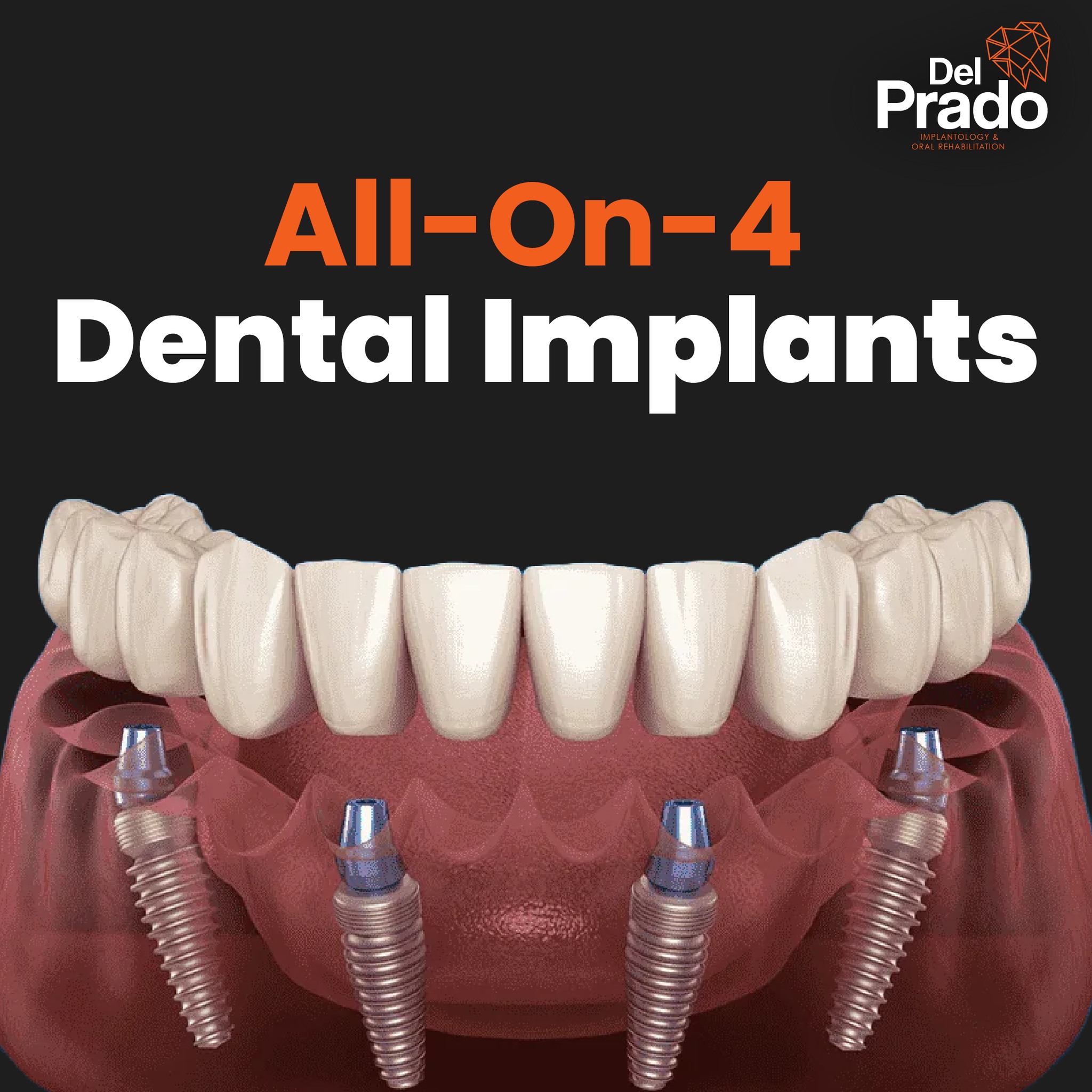 Del Prado Implants Facebook ad