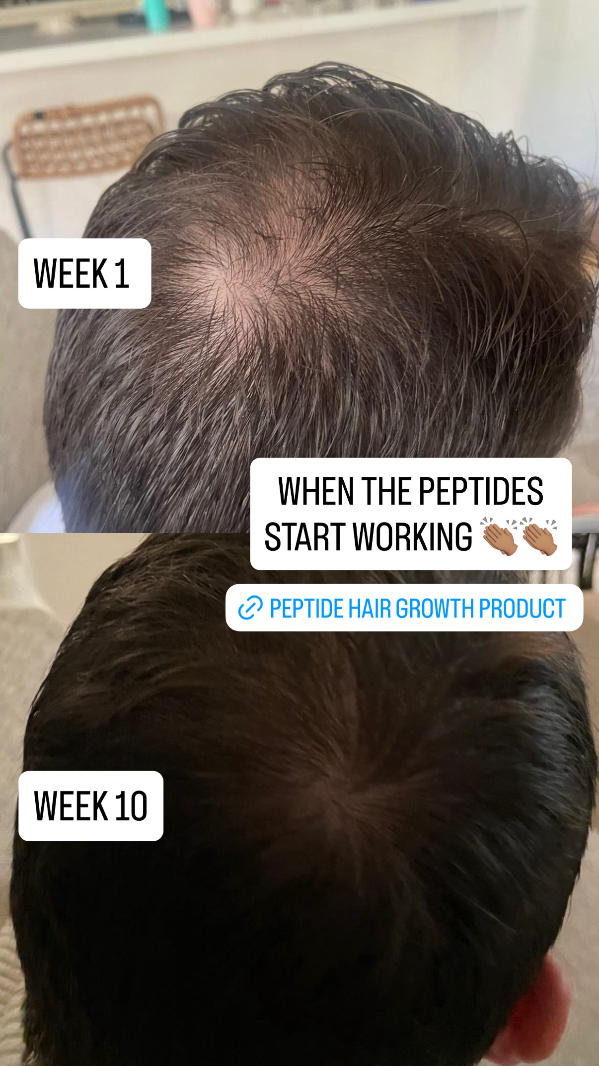 JSHealth Vitamins Facebook ad: Thicker Hair Starts Here + FREE Scalp Massager!