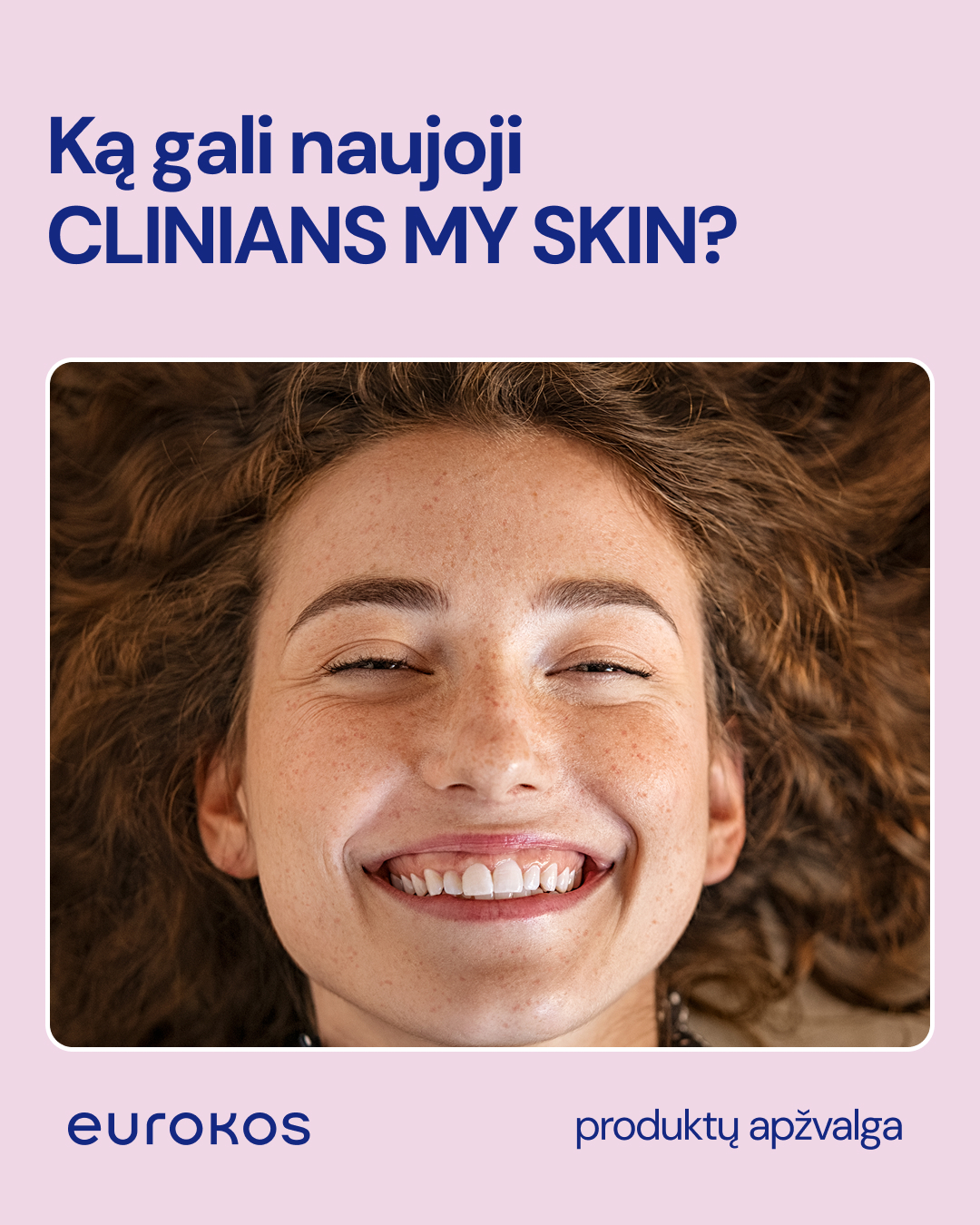 EUROKOS Facebook ad: Apsaugok savo odą nuo miesto taršos ir streso!