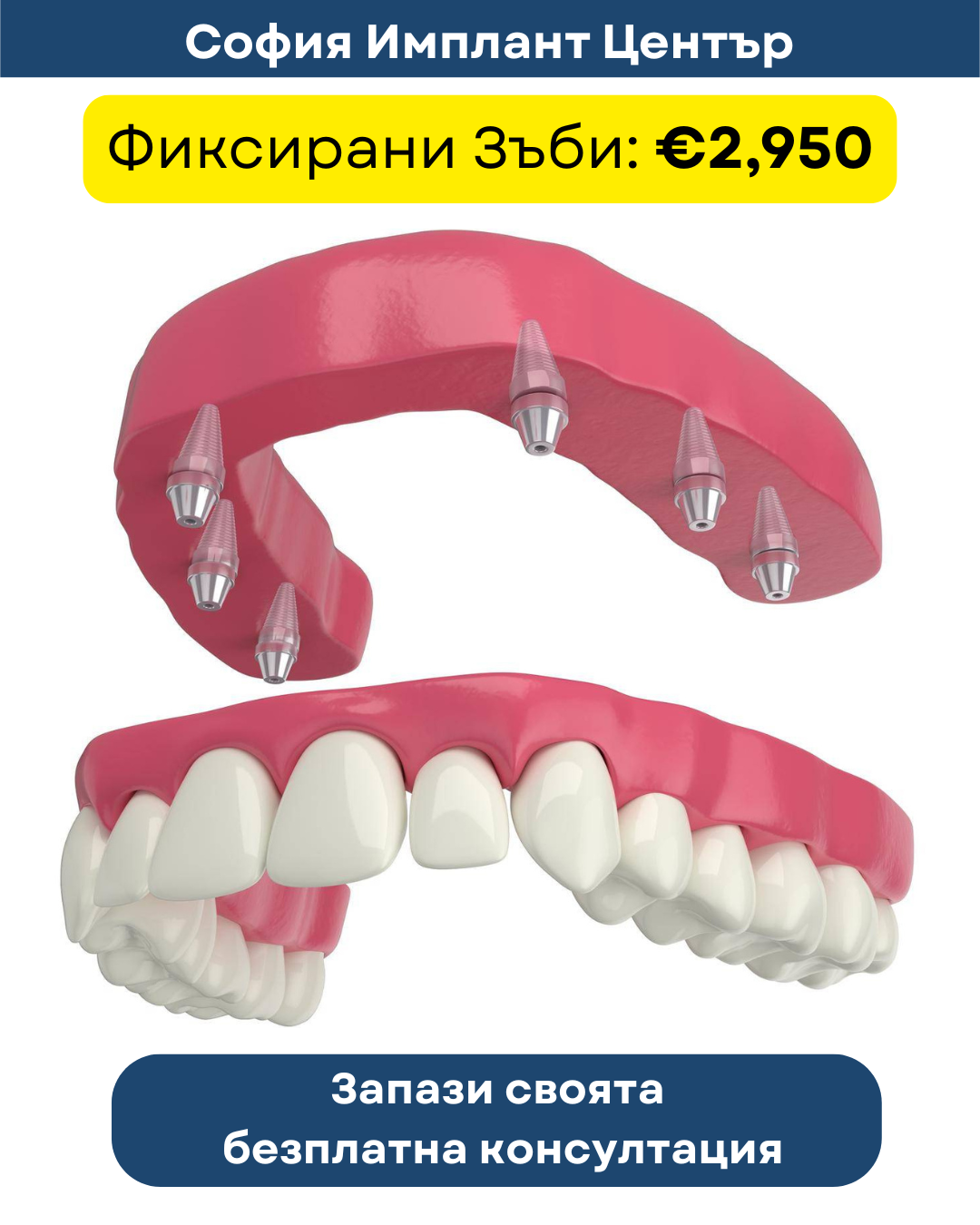 Sofia Implant Centre Facebook ad