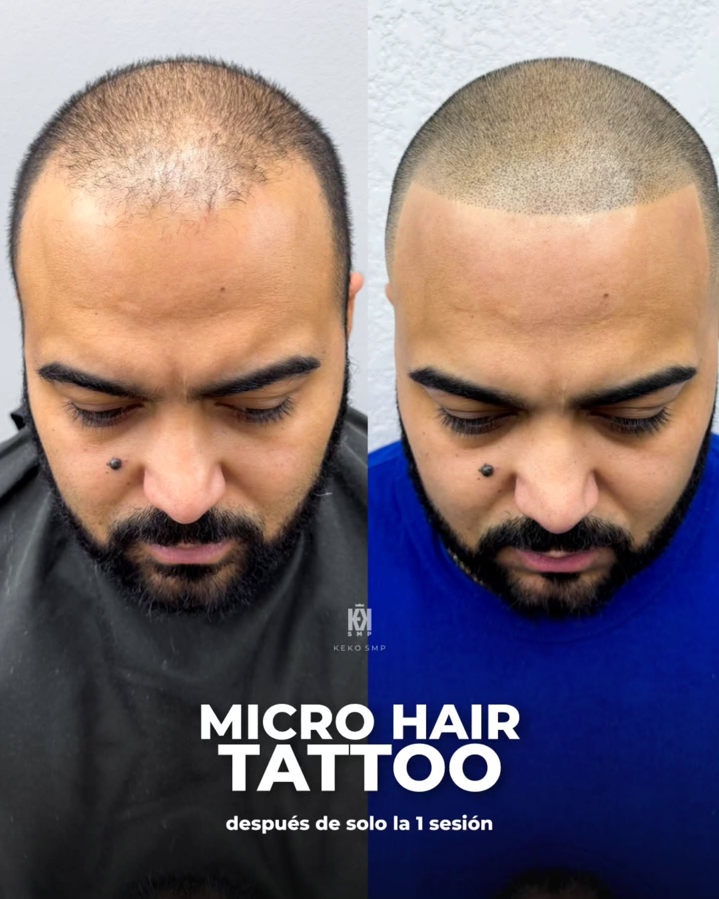 keko_smp Facebook ad: Ya no es solo una cuestión de estética…
