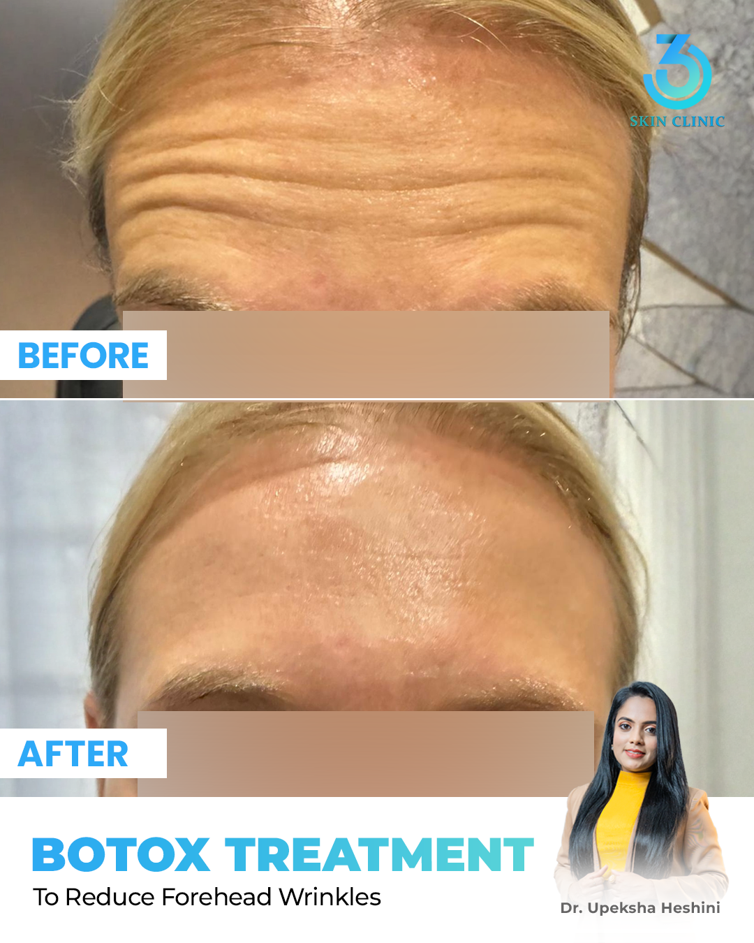 360 Skin Clinic Facebook ad: වයස කියන්නේ හුදෙක් ඉලක්කමක් පමණක් බව ලොවට පෙන්වන්න!