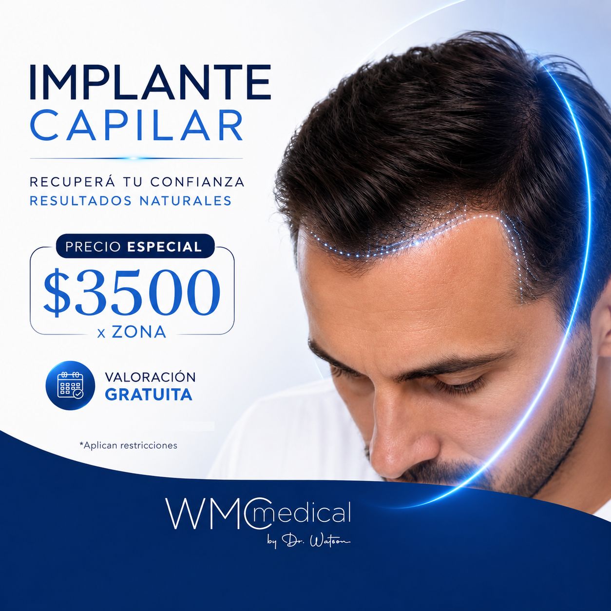 WMC Medical Facebook ad: Promo Implante Capilar