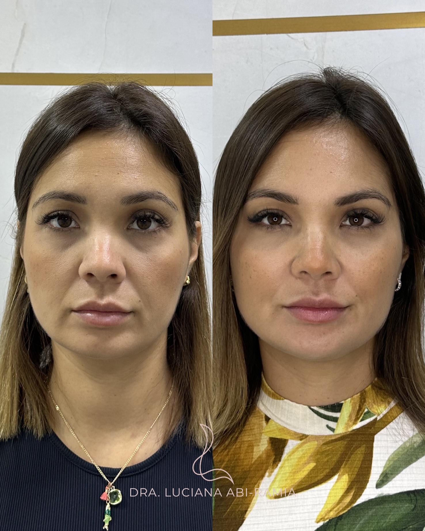 Luciana Abi-Ramia Facebook ad: Ela já era linda, mas estava sentindo os…