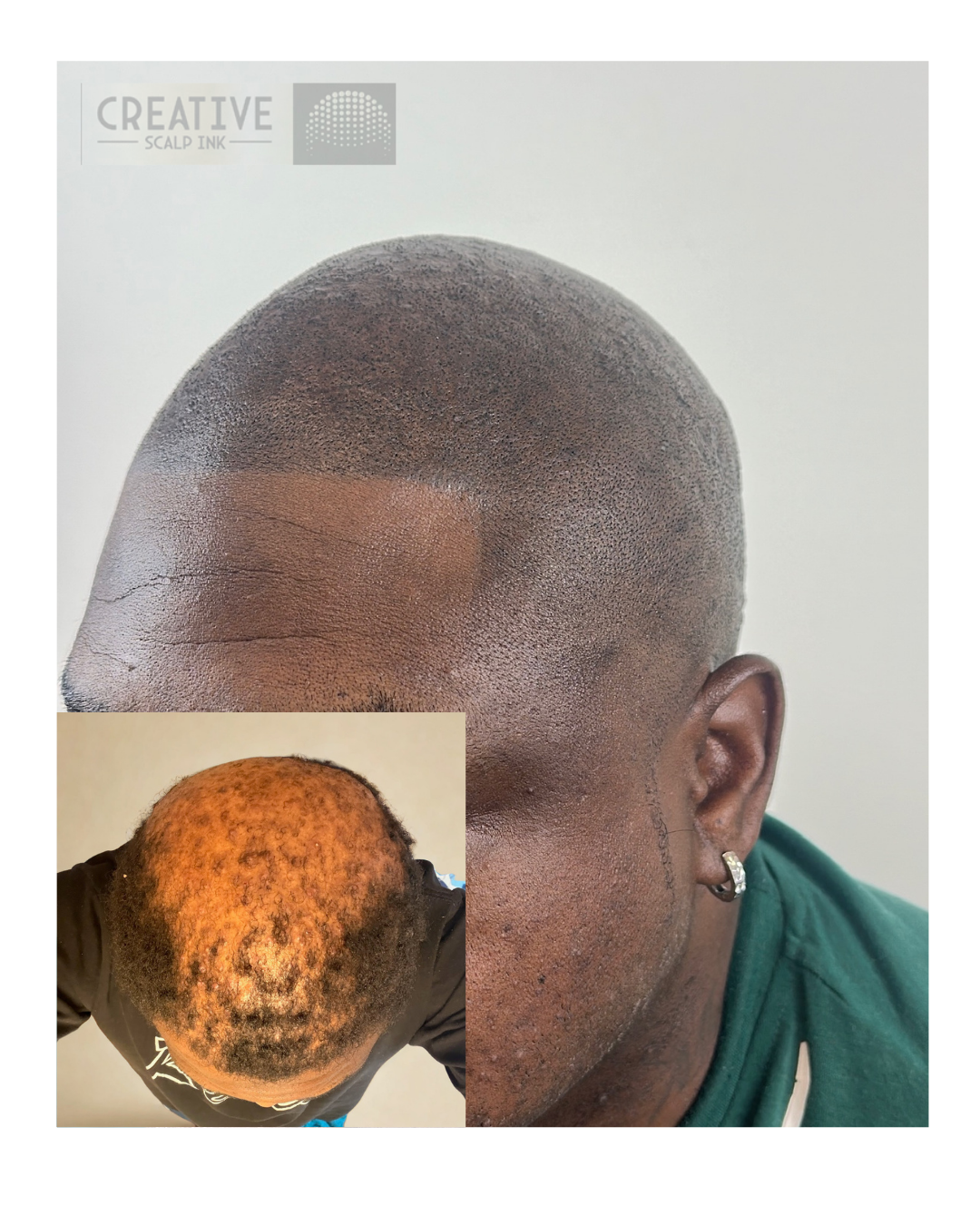 Creative Scalp Ink Facebook ad: Regain Your Confidence
