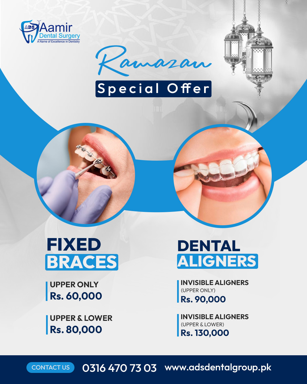 Aamir Dental Surgery Facebook ad: Offer Valid Only This Month of Ramadan!