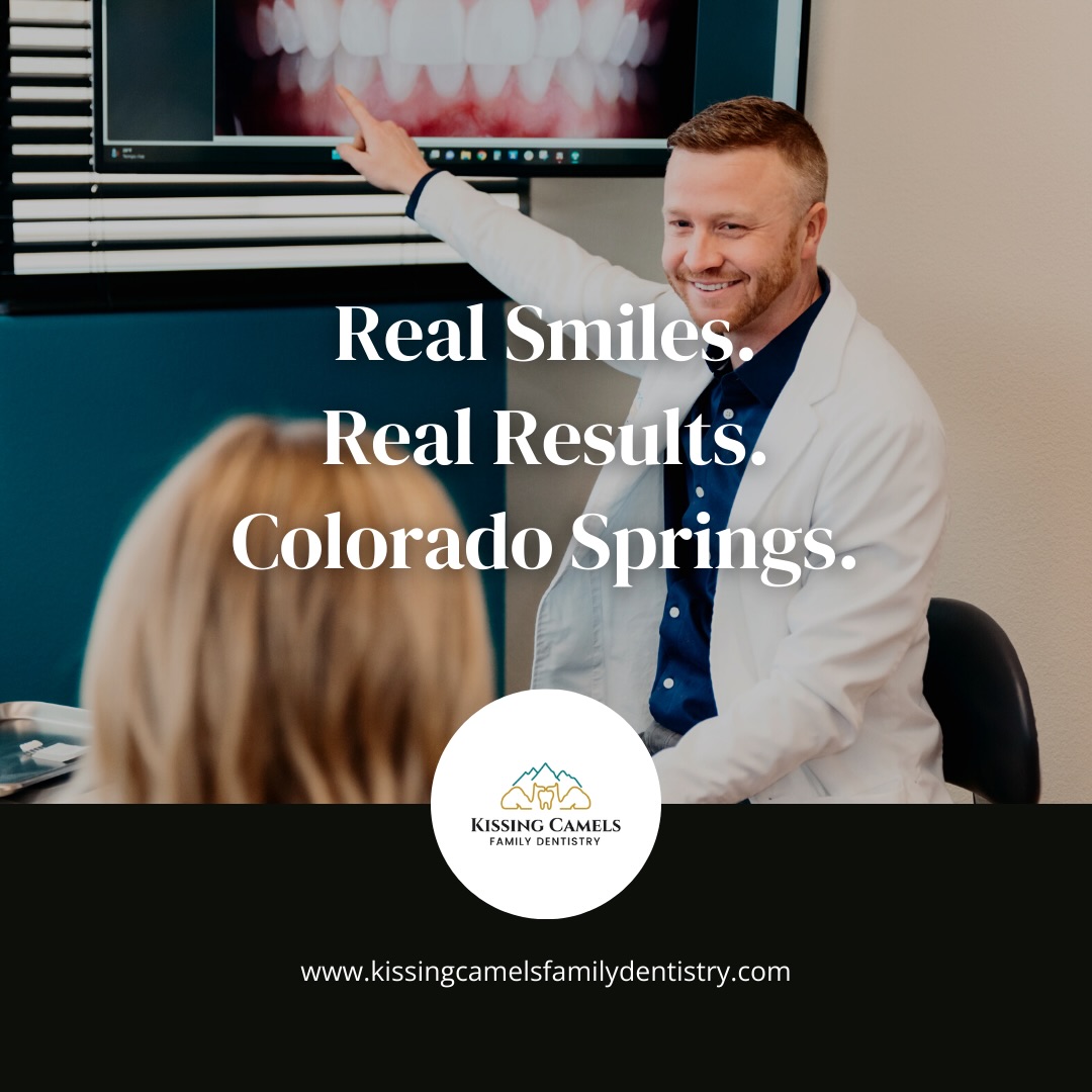 Kissing Camels Family Dentistry Facebook ad: Behind every smile transformation is careful planning…