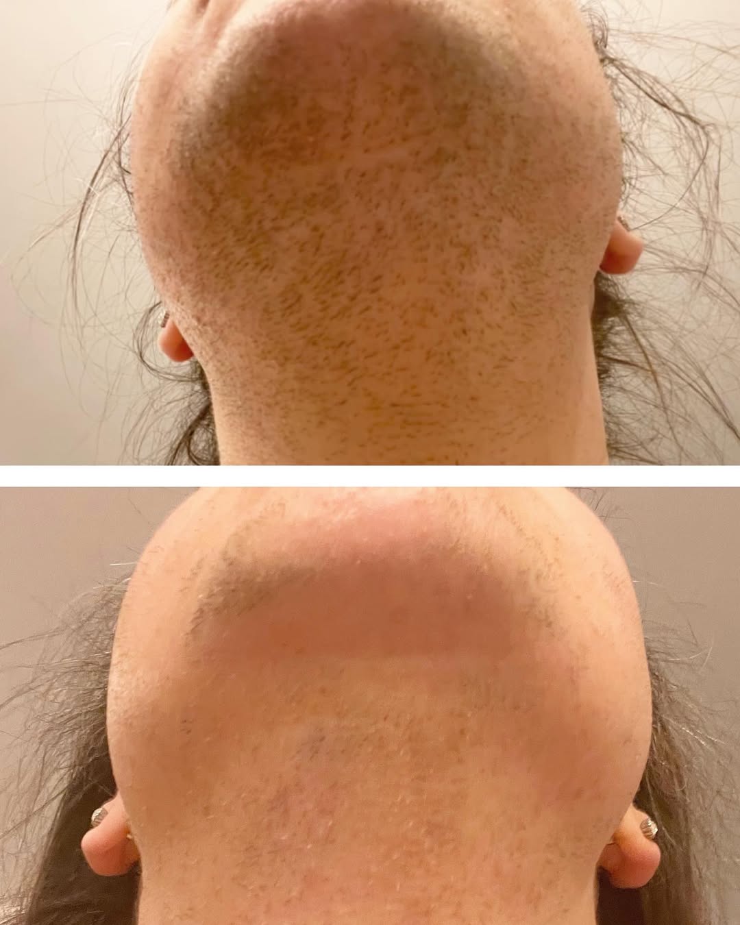 Cosmetic Insider Facebook ad: Why so many women who pluck still grow back thicker