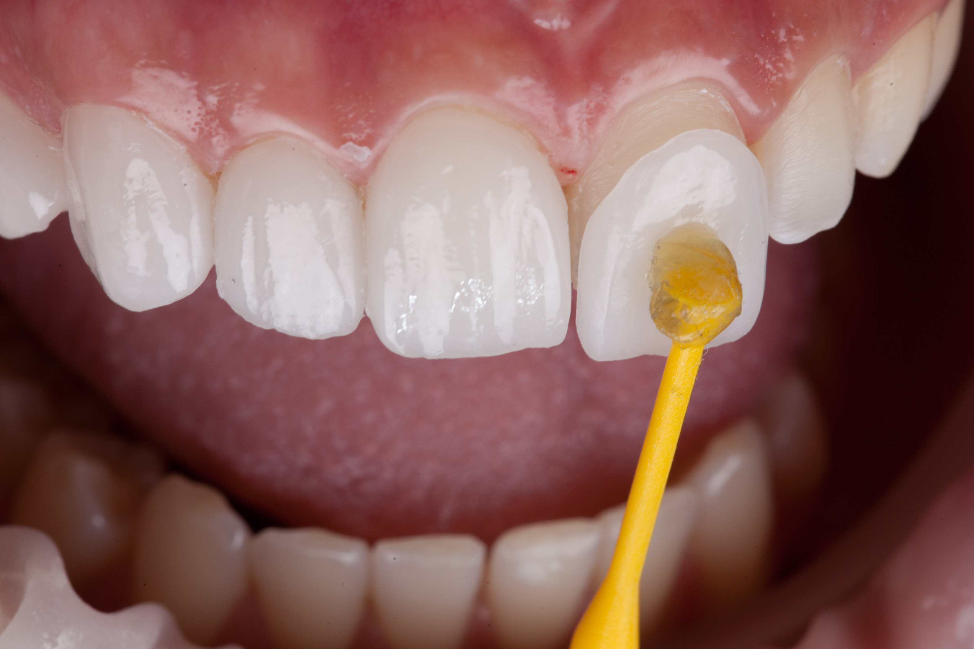 All Smile Care Facebook ad
