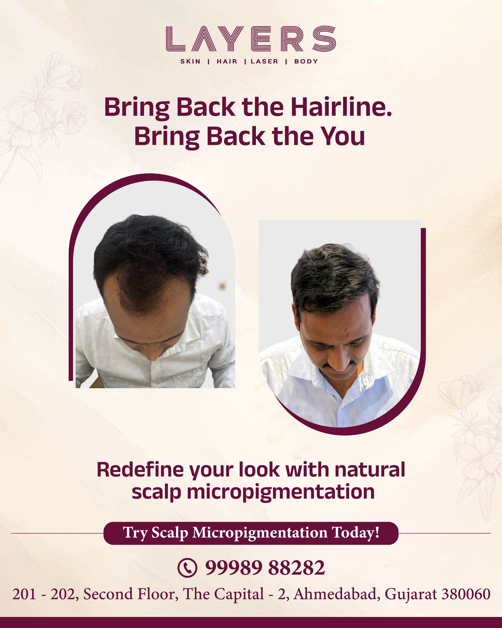 Layers Skin & Hair Clinics - Gujarat Facebook ad: Bring Back the Hairline.