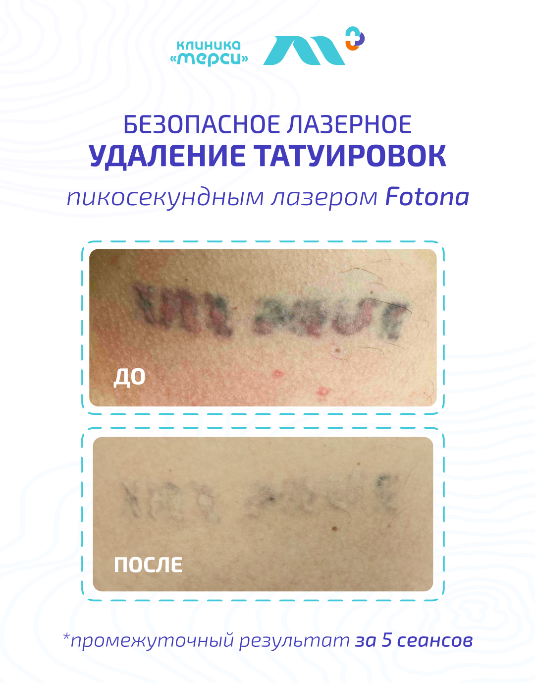 Косметологический центр Клиники «Мерси» Facebook ad from Apr 28, 2026