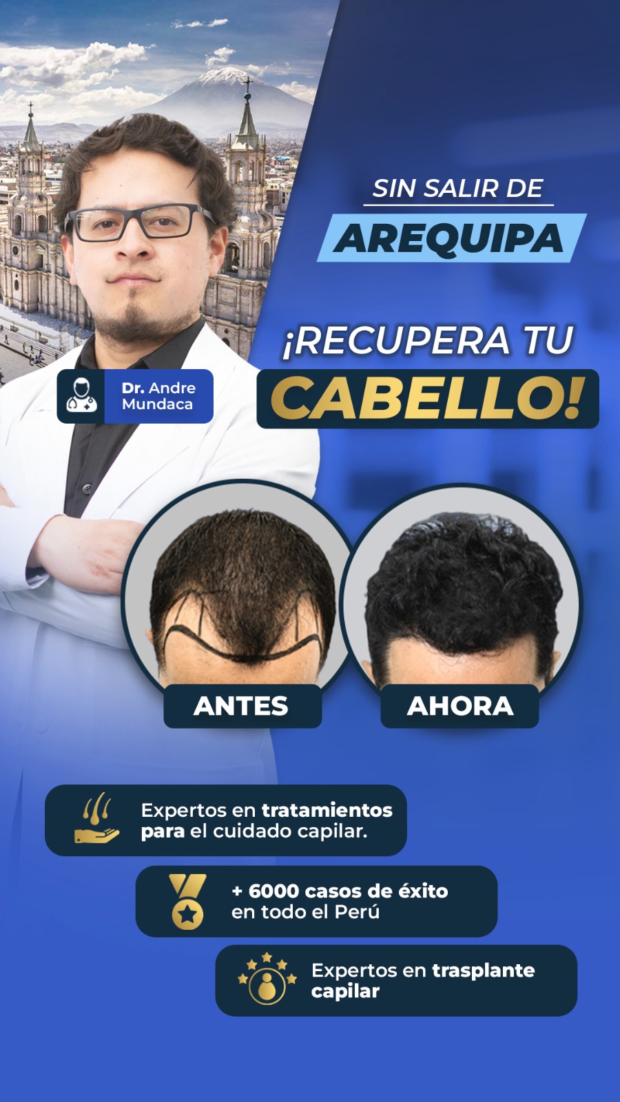 Perfection capilar - Trasplante capilar Facebook ad from Mar 1, 2026