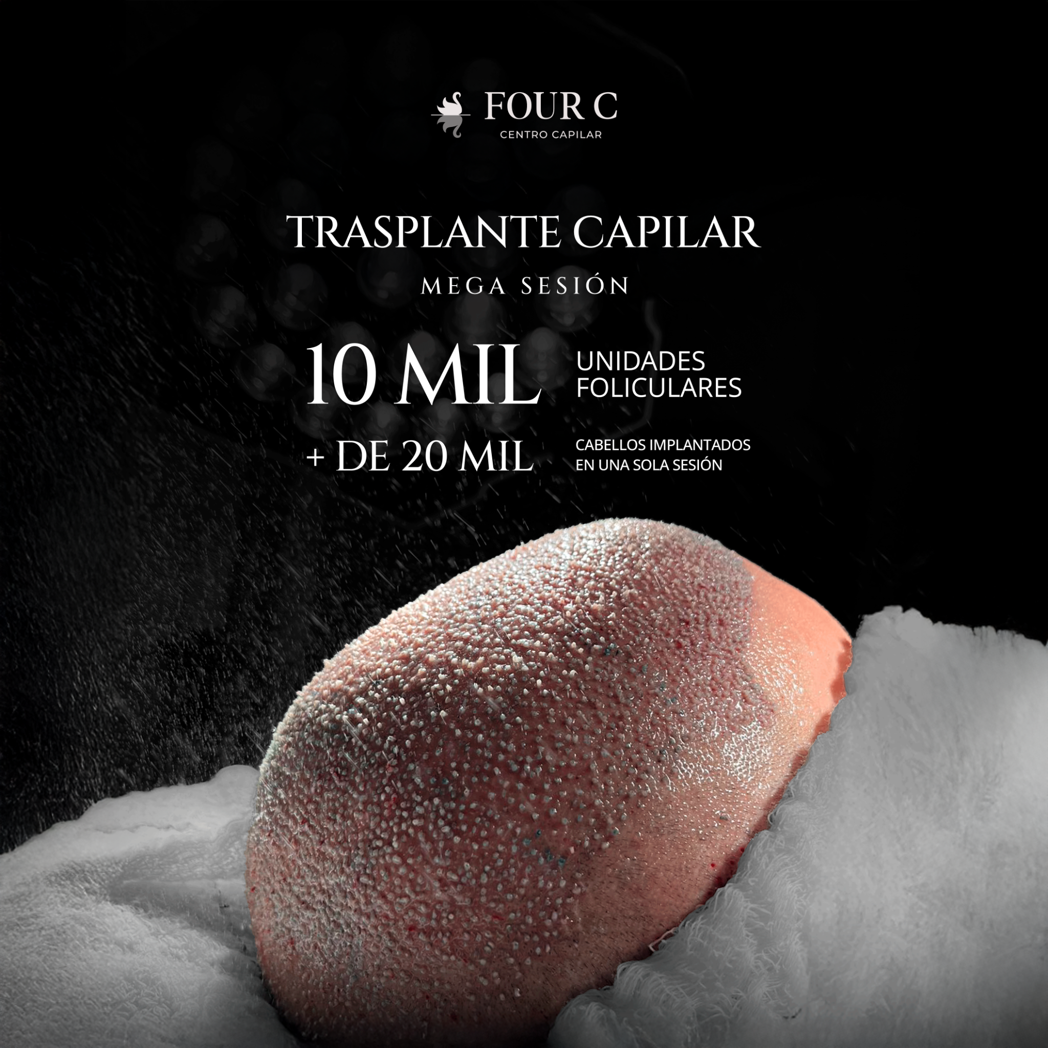 FOUR C Centro Capilar Facebook ad from Jan 30, 2026