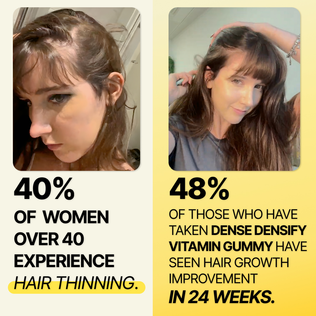 Dense Hair Experts Facebook ad