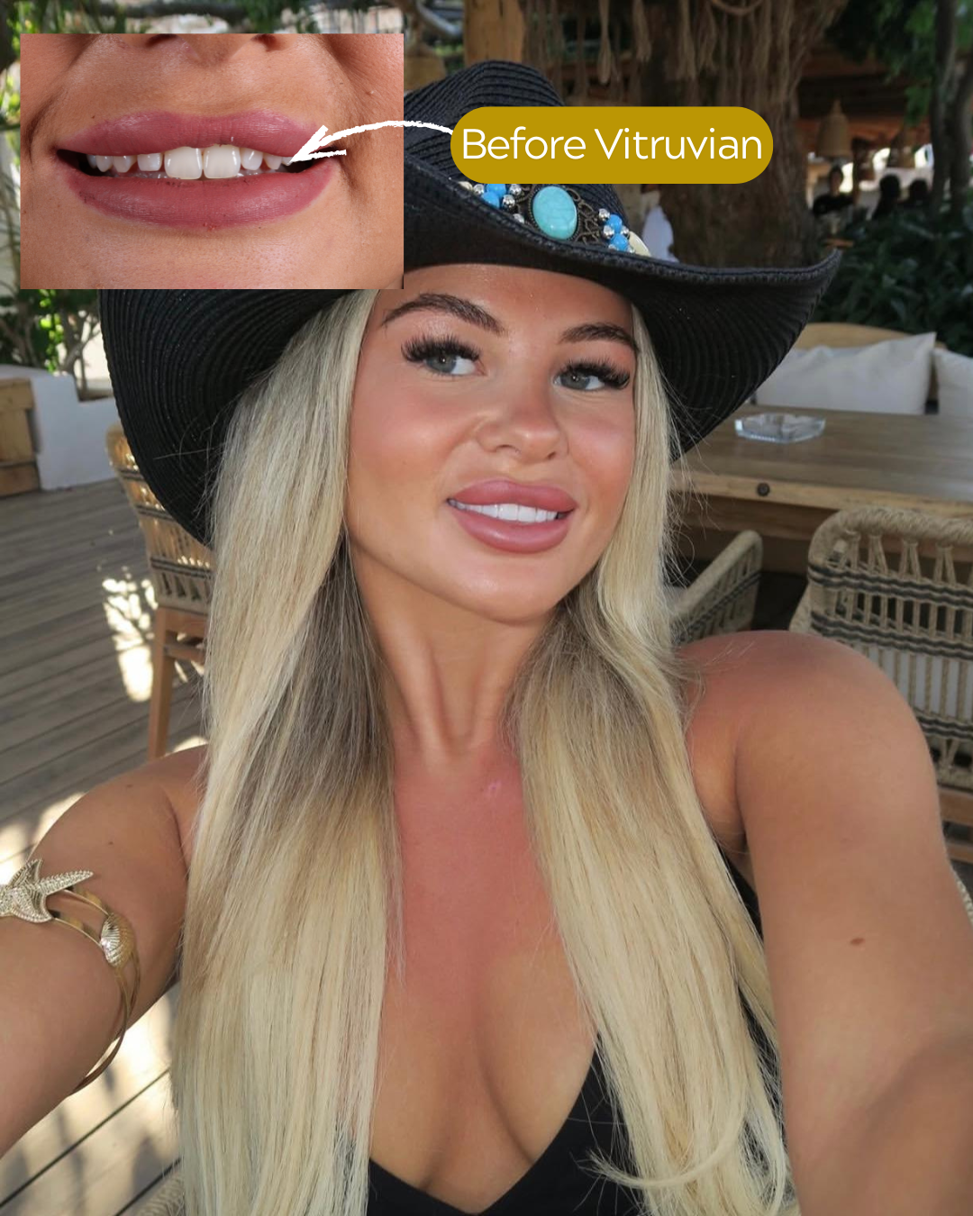 Vitruvian Cosmetic Dentistry and Implant Studio Facebook ad
