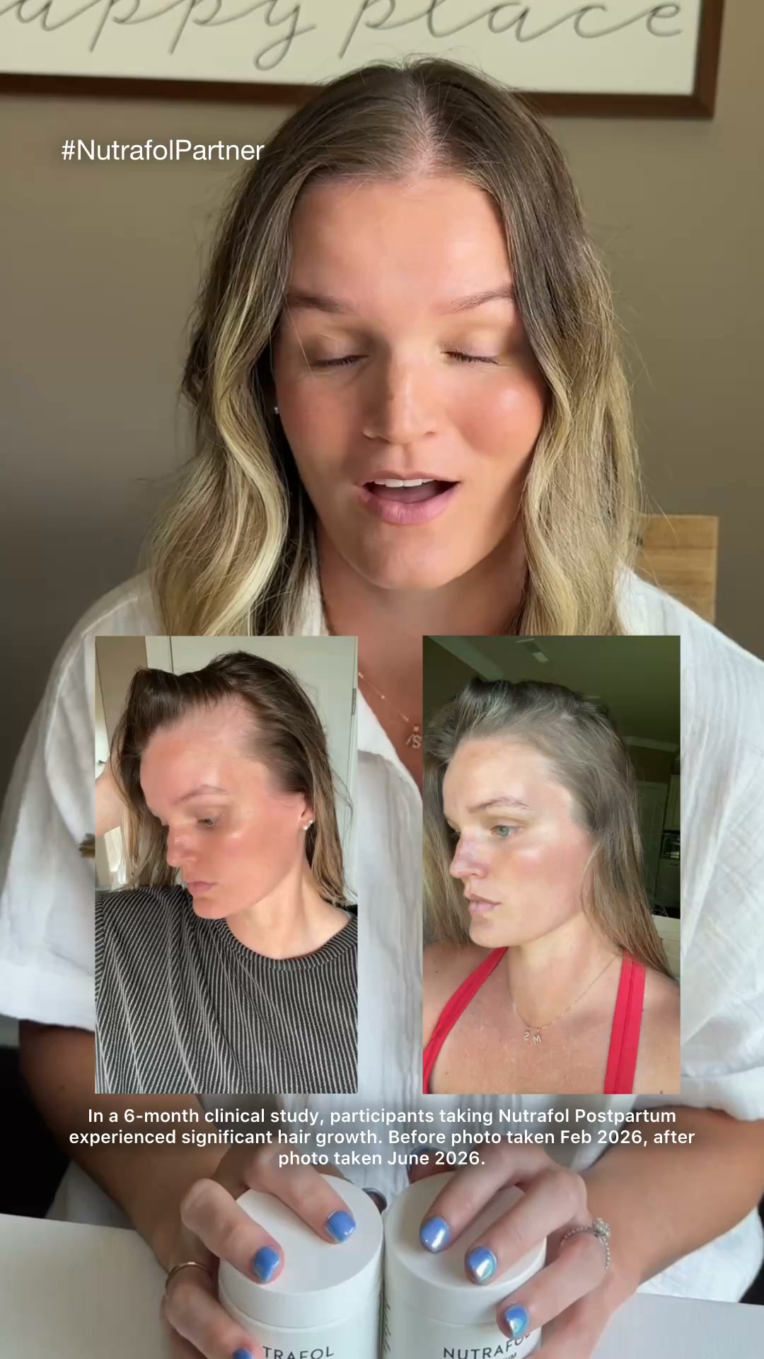Nutrafol Facebook ad: Made for postpartum hair changes.