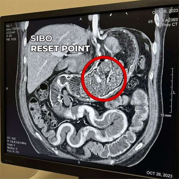 Dr. Cody Miller Facebook ad