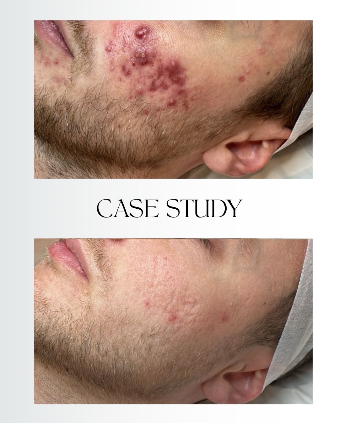 Ananya Clinic Facebook ad: This transformation is the effect of a structured…