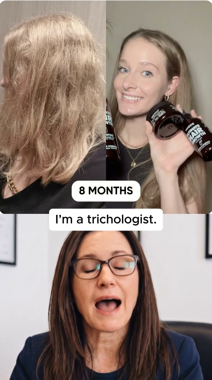 Prime Hair Daily Facebook ad: Unexpected Side Effects