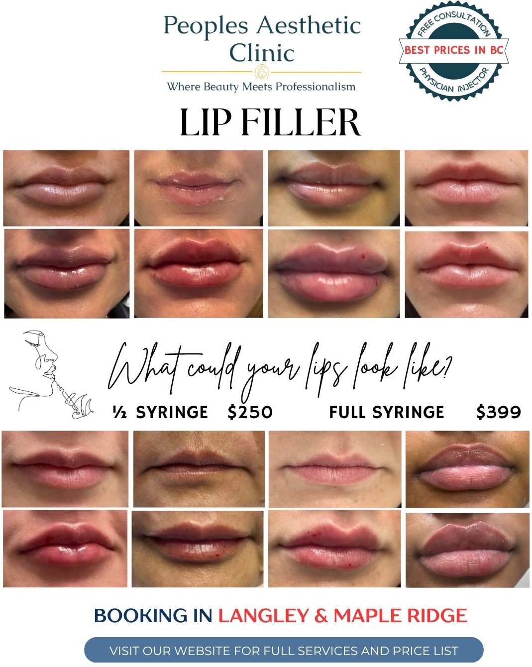 Peoples Aesthetic Clinic Facebook ad: If You’ve Been Thinking About Lip Filler… This…