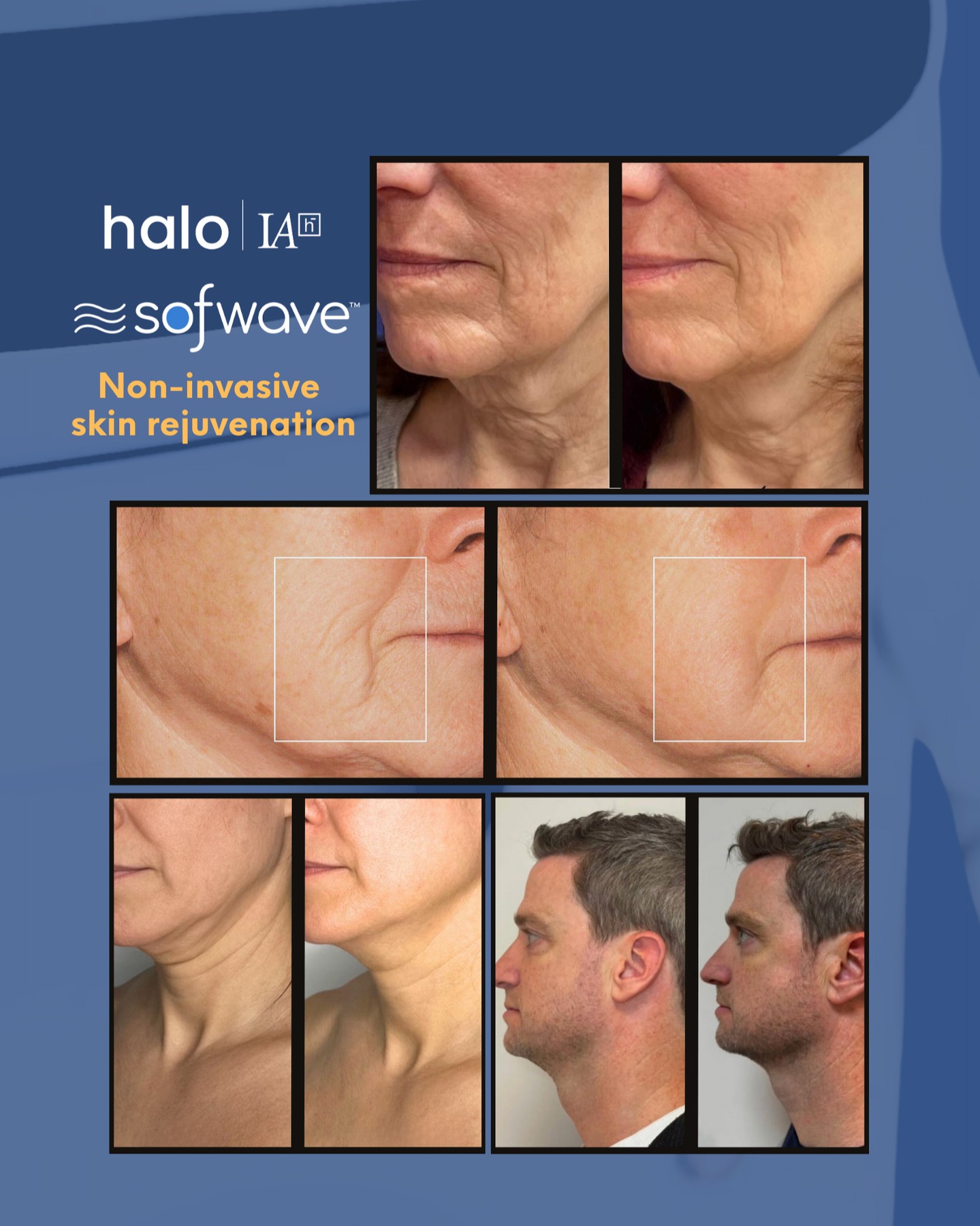 Halo Wellness & Aesthetics Facebook ad