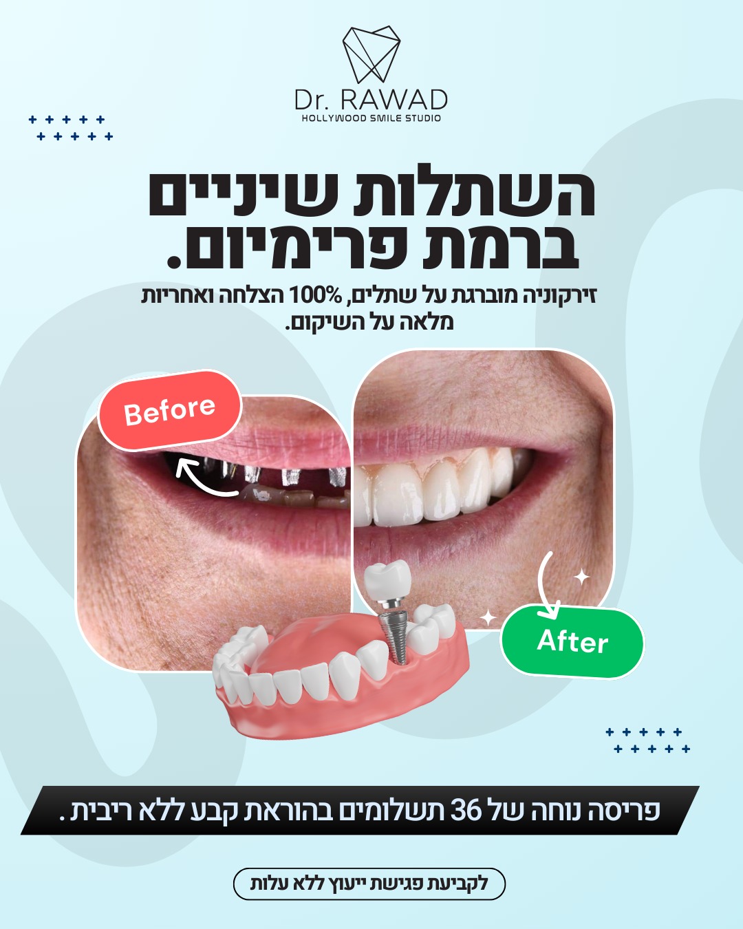 דר רואד רפואת שיניים אסתטית -סניף קריות חיפה Facebook ad from Mar 19, 2026