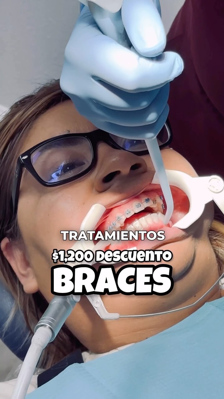 Happy Smiles Facebook ad: Transformar tu sonrisa con tratamientos de ortodoncia de…