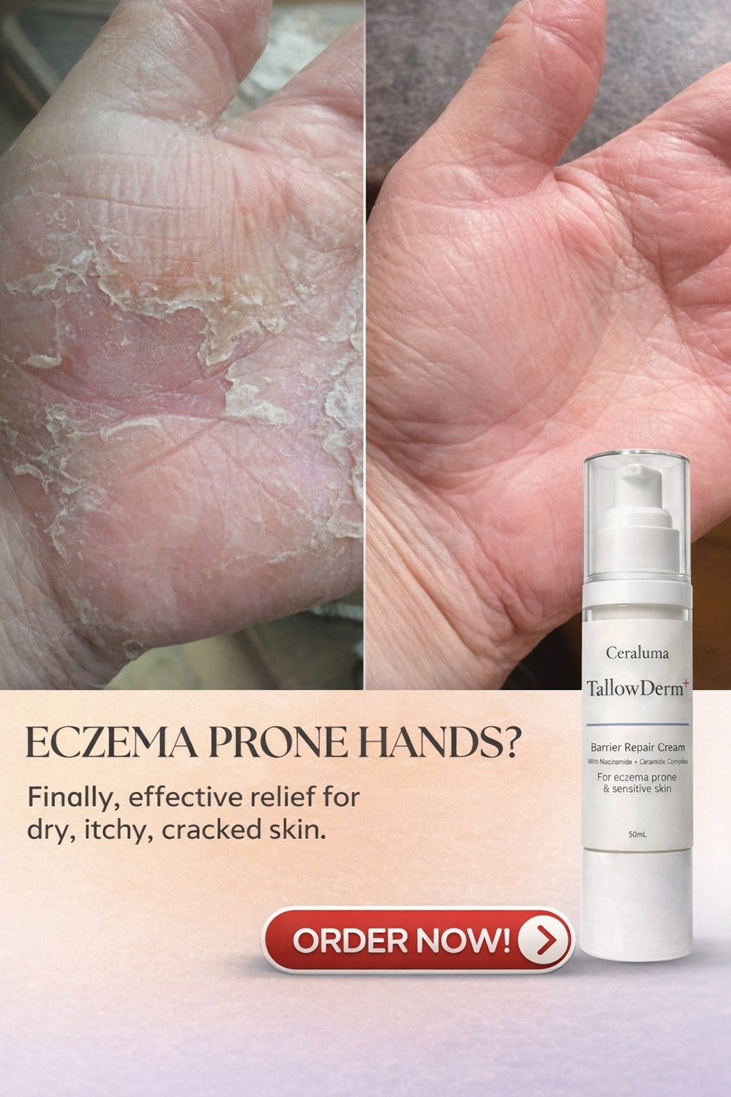 Ceraluma TallowDerm+ Facebook ad