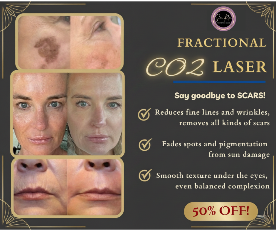Sara Aesthetic Clinic. Facebook ad: 50% OFF CO2 Ablative Laser, Smooth, Clear, Renew