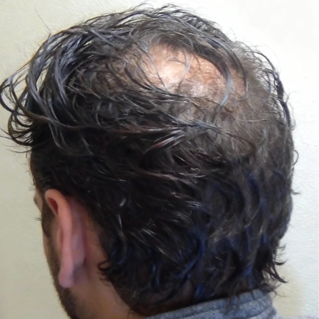 Dr. Alex Hair Expert Facebook ad