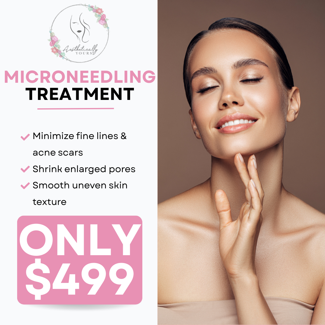 Aesthetically Yours Facebook ad: $499 PRP Microneedling Treatment!