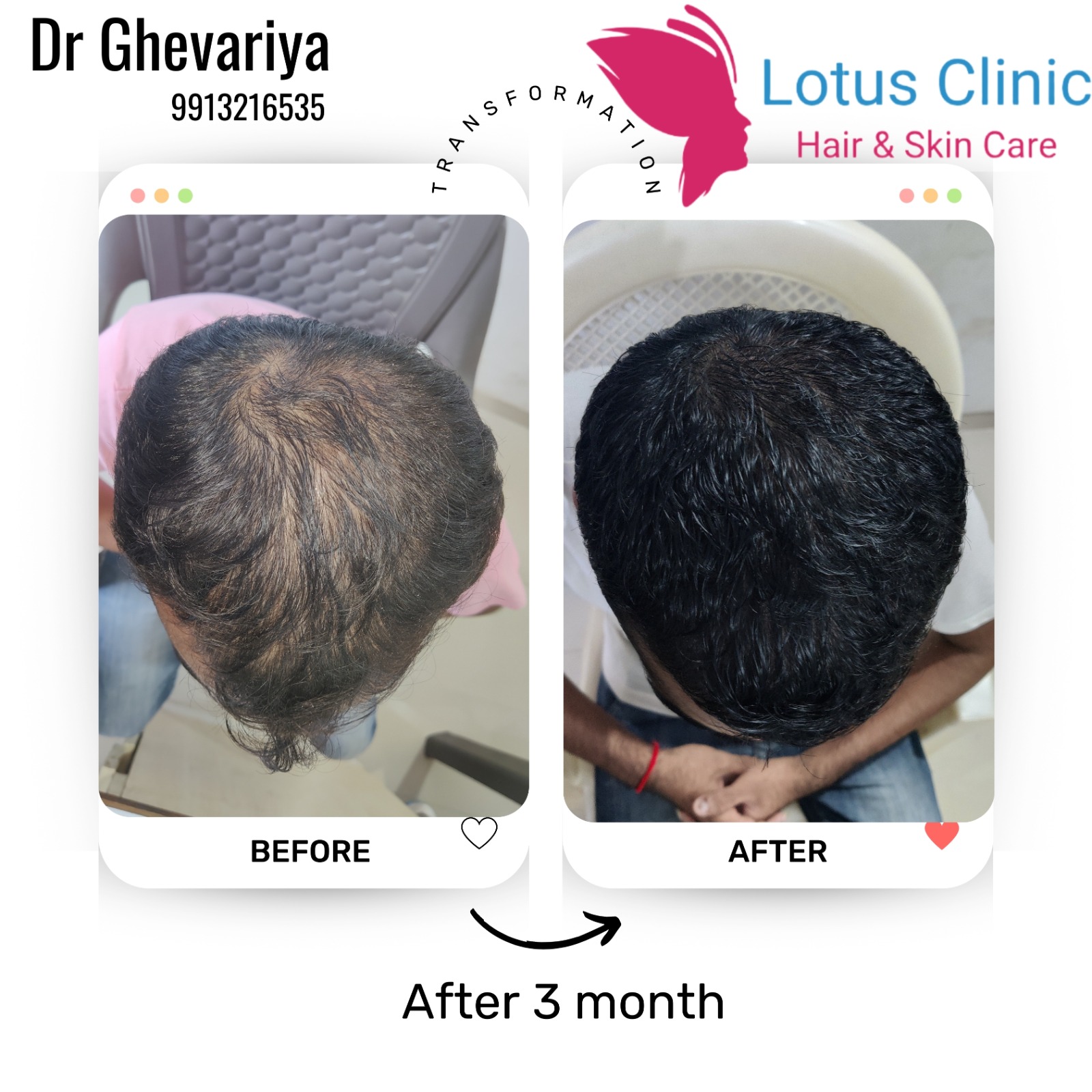 Dr ghevariya Facebook ad: હમણાં જ કોલ કરો