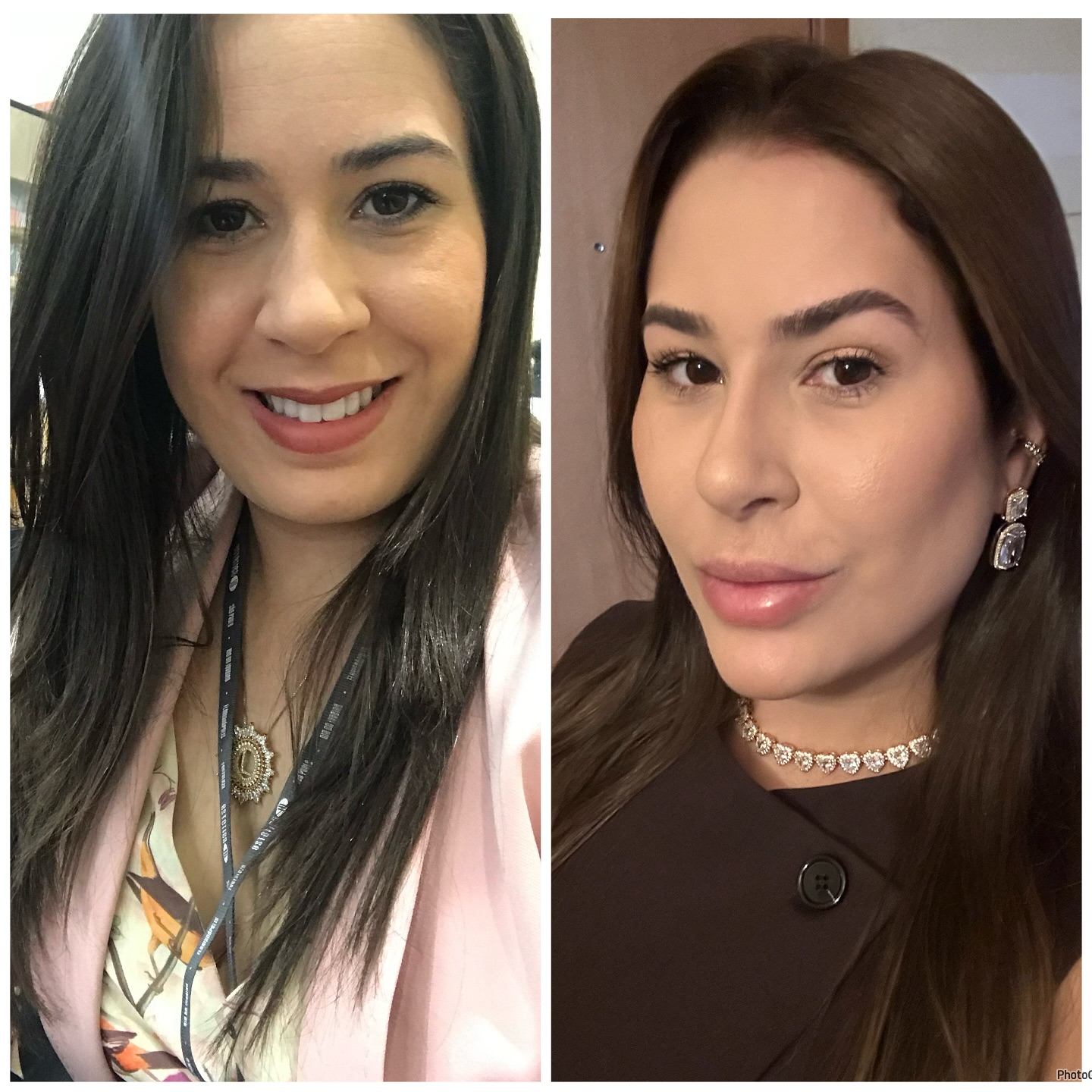 Dra. Lorena Pinheiro Facebook ad: Mais um antes e depois de um dos…