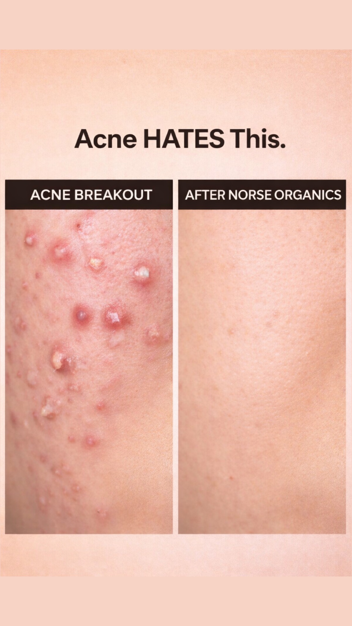 Norse Organics Facebook ad