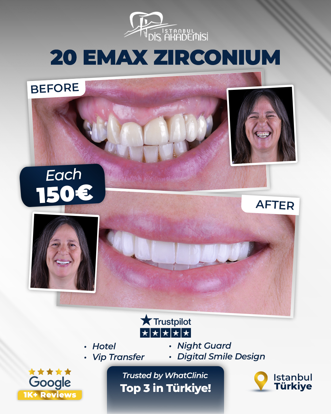 İstanbul Diş Akademisi Facebook ad: A confident smile starts here